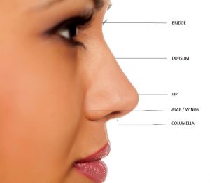 Hybrid rhinoplasty operasi hidung dengan menggunakan implan dan tulang rawan telinga ( ear cartilage)